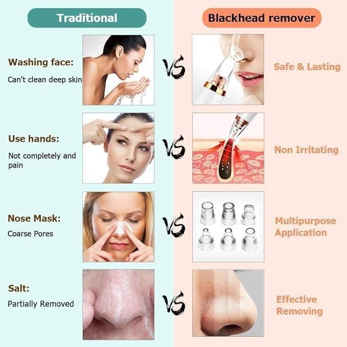 6-in-1 Blackhead Remover Kit